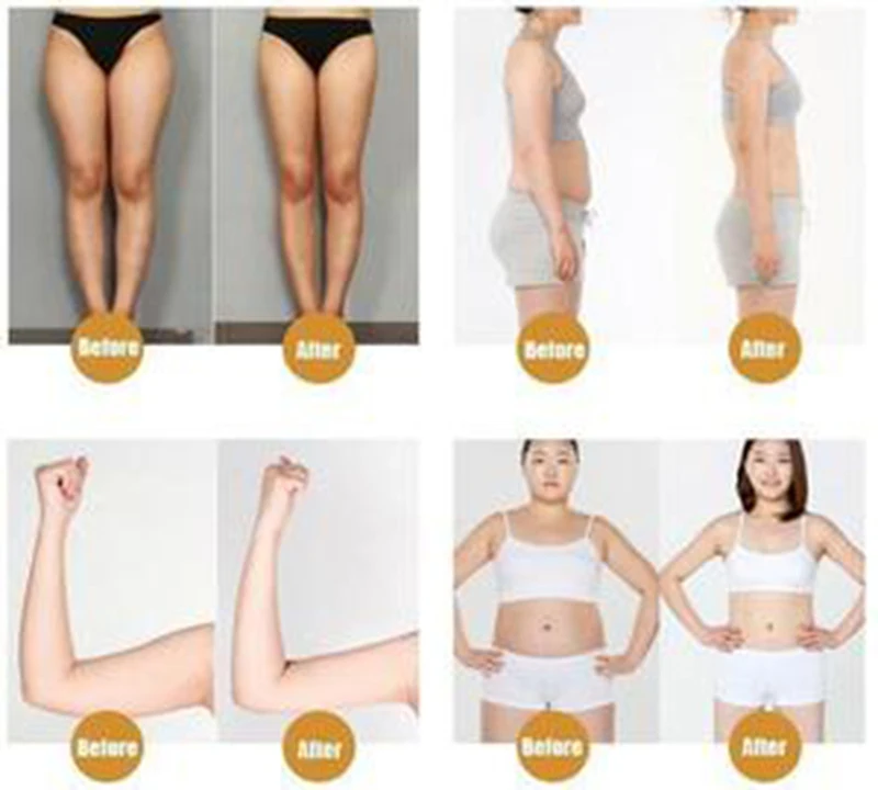 CELLULITU-USUWANIE-KREM-SPALANIE-T-USZCZU-KREM-WYSZCZUPLAJ-CY-MI-NI-RELAXER-na-drop-shipping-krem (2)