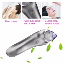 Прямая поставка; специальная ссылка