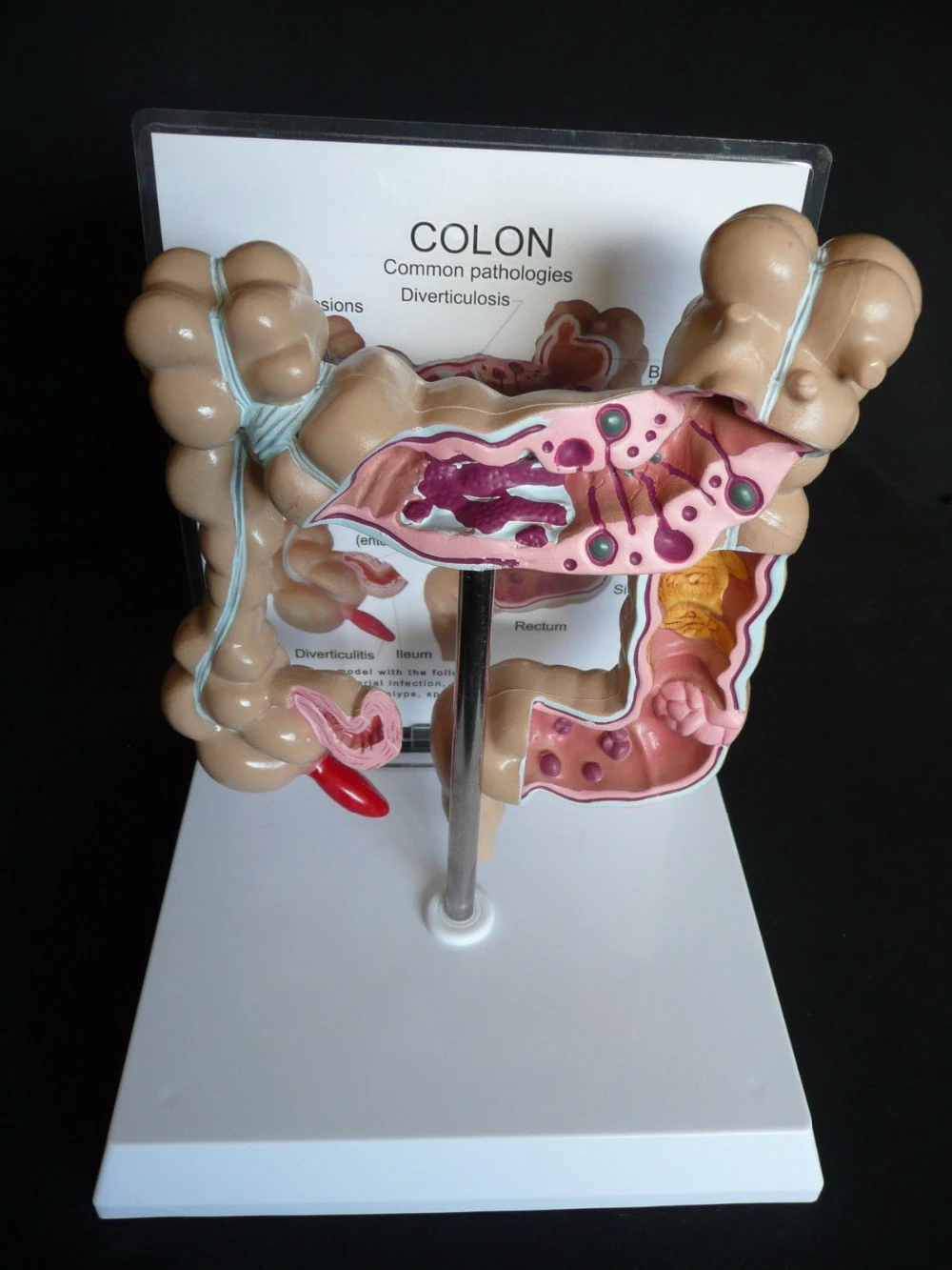人間のコロン病理学的疾患 Modelskeleton 解剖頭蓋骨解剖脳モデルミキサーで外傷 Esqueleto Anatomia Skull Anatomical Brain Modelanatomical Brain Model Aliexpress