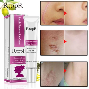 

RtopR Acne Scar Stretch Marks Remover Cream Skin Repair Face Cream Acne Spots Acne Treatment Blackhead Whitening Cream Skin Care