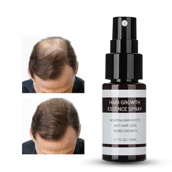 

20ml Hair Growth Essence Spray Anti Hair Loss Treatment Essence Nourishing Enhancing Hair Roots