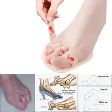 1 пара молоток разделитель пальцев ног вальгусная деформация ортопедические подушки подгибка деформация Наложение стопы коррекция носка носки