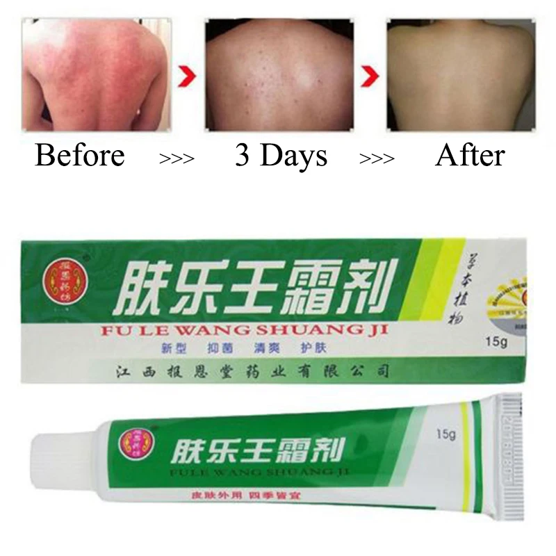 

20Pcs Psoriasis Dermatitis Cream Antipruritic Analgesic Balm Ointment for Dermatitis and Eczema Pruritus Body Massage Patches