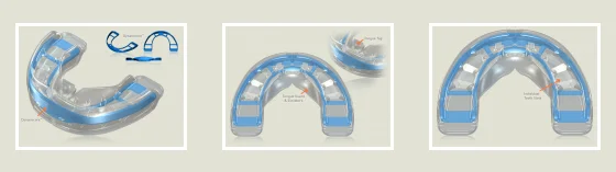 MRC тренажер T3 с постоянным использованием зубной ортодонтический тренажер T1/T2/T3