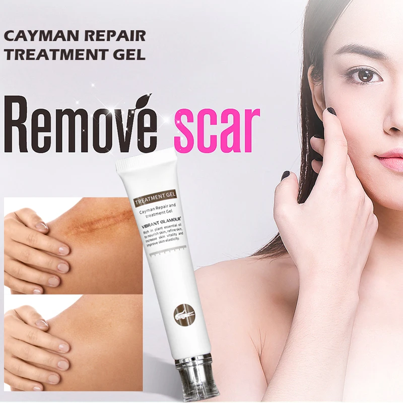 VIBRANT GLAMOUR Repair Scar cream Removal Acne Scars Gel Stretch Marks Surgical Scar Burn Body Pigmentation Corrector Care 2pcs