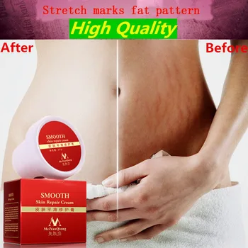 

Smooth Repair Cream For Stretch Marks Scar Removal To Maternity Skin Remove Scars Postpartum Body Care 88