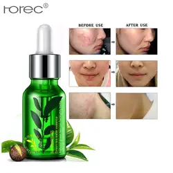 Стремление к леди ROREC зеленый чай seed moisturizing Facial essence сущность увлажнение Elite жидкости мягкий и глубоко питательный гель для кожи