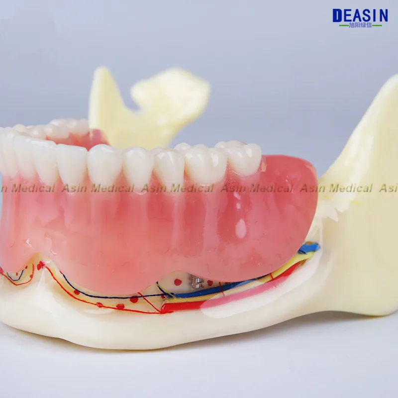 Высокое качество Смола Покрытие мандибулярных зубных протезов модель мандибль пояс модель нерва дисплей зубные протезы съемные зубы модель