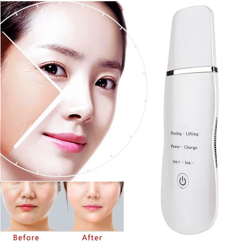 2018 Skin Scrubber Massager Machine Facial Skin Deeply Cleaning Device Anion Face Skin Care Peeling Lifting Scrubber 2018 Skin Scrubber Massager Machine Facial Skin Deeply Cleaning Device Anion Face Skin Care Peeling Lifting Scrubber