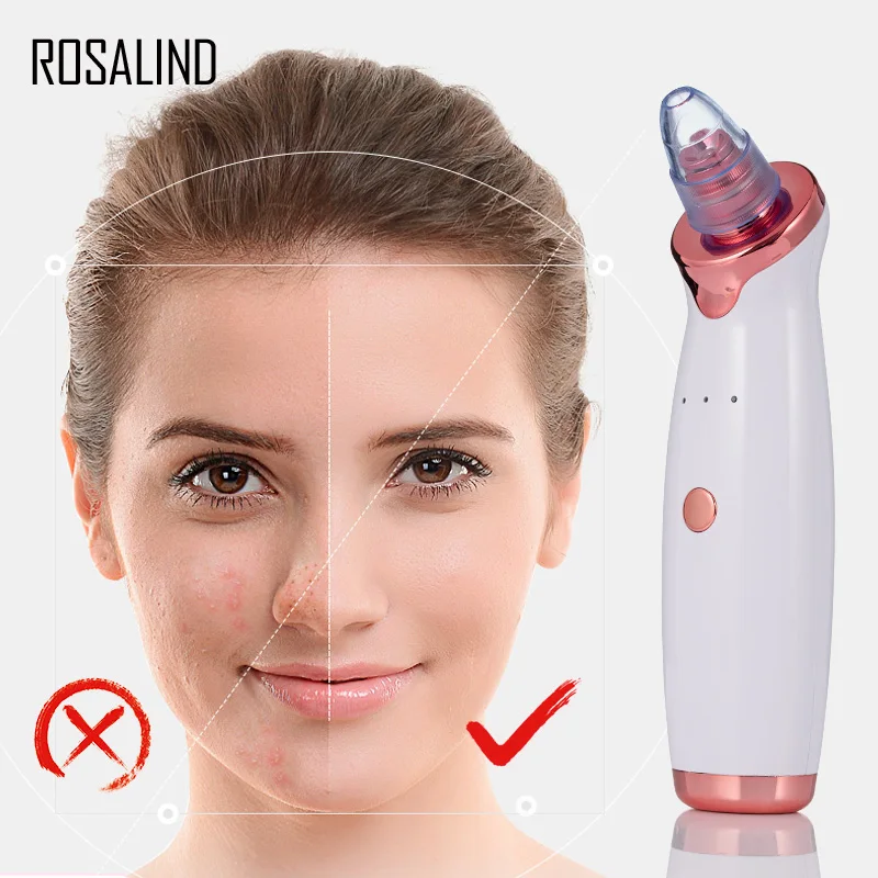 ROSALIND Blackhead Remover пылесос с usb зарядкой черный точечный очиститель пор для лица Pimple пятновыводитель для кожи средства ухода за мотоциклом