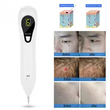 Lcd Pro моль карандаш для удаления веснушек Три регулируемые уровни пятна удаление татуировки очиститель пор бородающая удаление инструмент для ухода за кожей