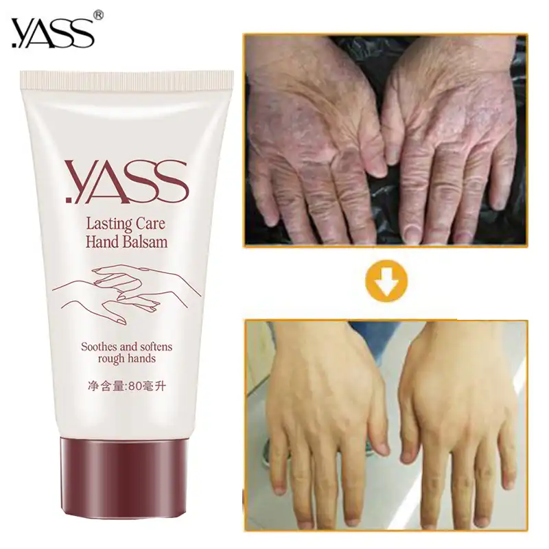 anti wrinkle cream for hands