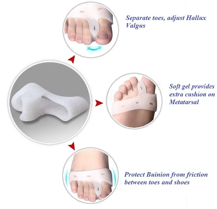 1 пара гель буйон вальгусная деформация ортопедический разделитель ног плюшевая подушка накладка на стопу стельки по уходу
