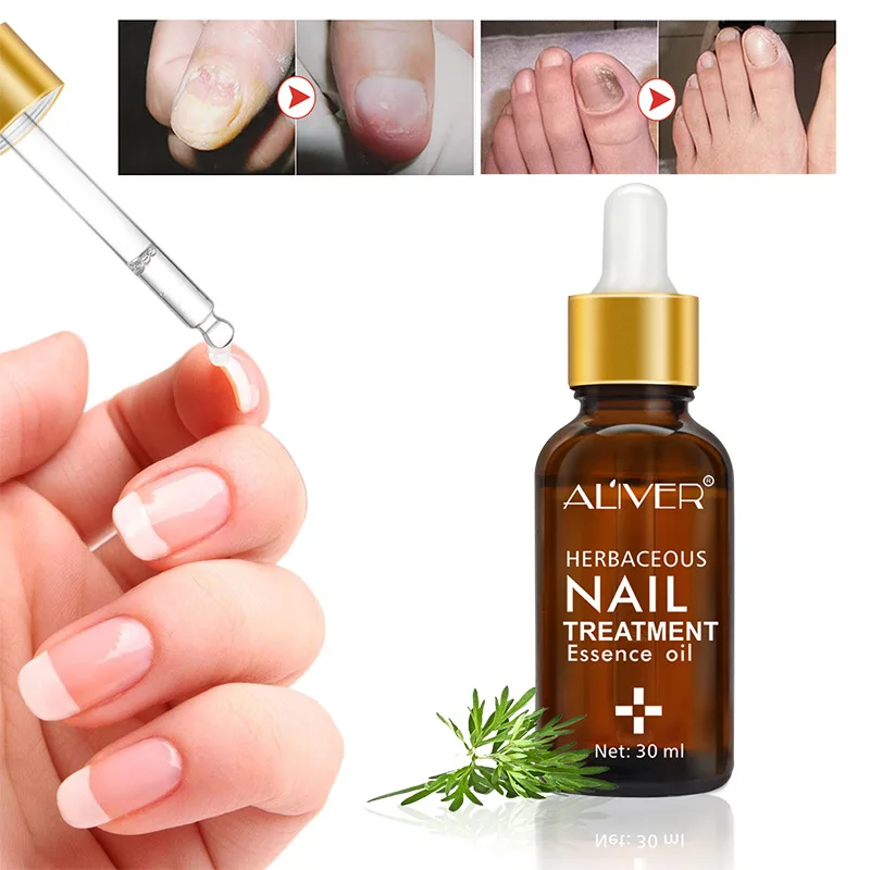 Nail Protector Skin Care Cream Nail Fungus Treatment Herb Nails Repair Cream Onychomycosis Paronychia Anti Fungal Nail Care
