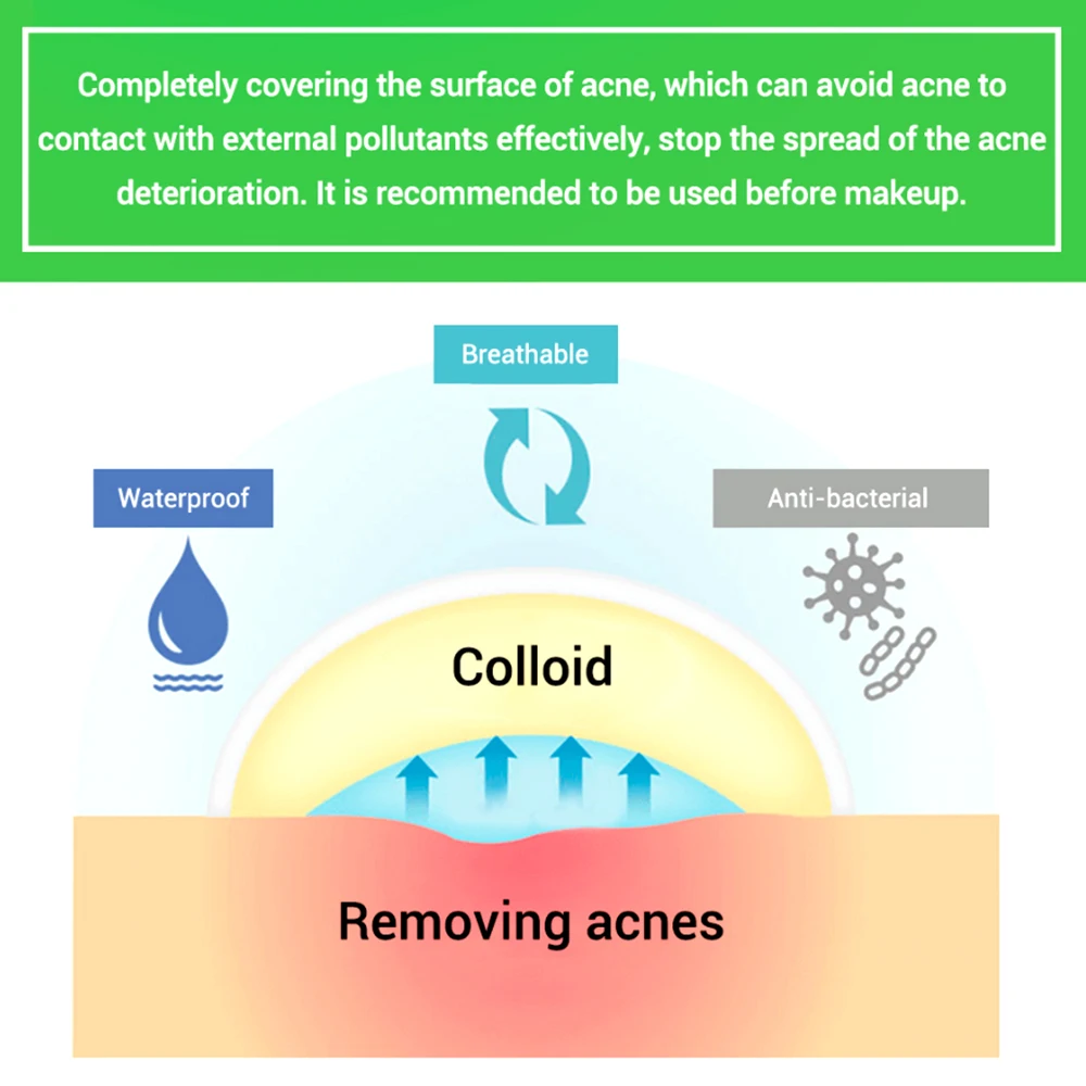 BREYLEE невидимое удаление акне подходит для ежедневного использования прыщей патч может поглощать акне секреции быстрое заживление уход за кожей лица