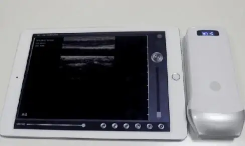 3.5-10.0 Mhz 80-129 elements wireless ultrasound
