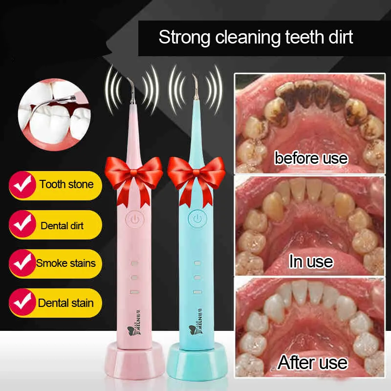 Buy Tooth stone remover To Tartar teeth stains tools