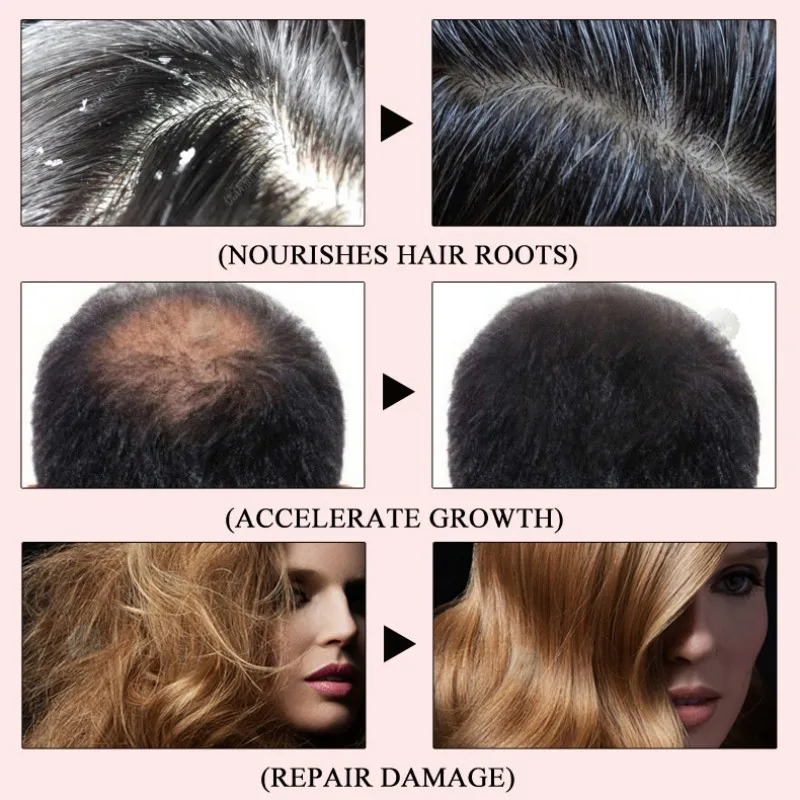 Продукты от выпадения волос быстрое мощное эфирное масло для роста волос Жидкое лечение Предотвращение выпадения волос уход за волосами