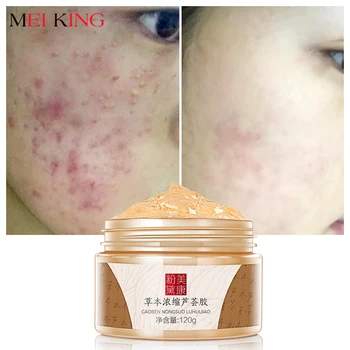 

MEIKING Aloe Vera Gel Day Creams 120g Anti Winkle Whitening Moisturizing Anti Acne Treatment Oil Control Face Cream Skin Care