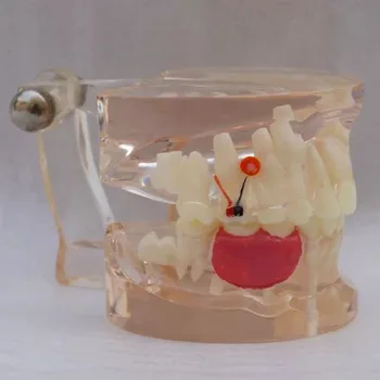 

Dental Clear Mixed with missing teeth model Oral Tooth Model