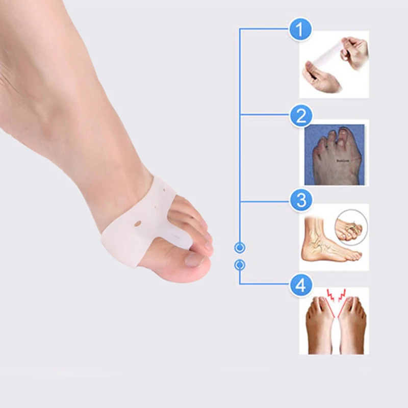 2Pcs=1Pair Hallux Valgus Orthotics Bone Thumb Corrector Big Toe Separators Aligner Toes Support Bunion Straightener Foot Massage