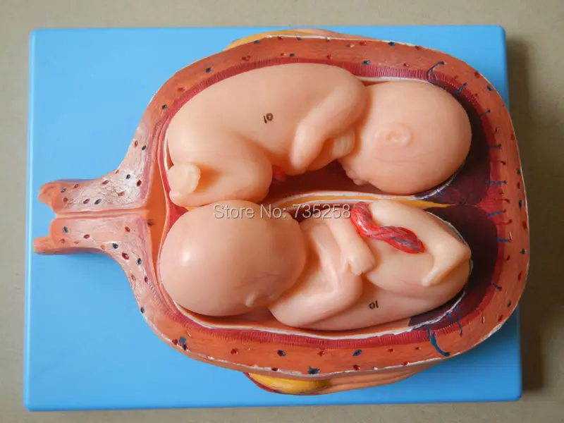 Пять месяцев беременных близнецы модели, близнецы плодов модель, 20 недель близнецов плодов модель, пятый месяц Близнецы Беременность