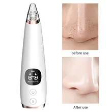 Набор инструментов для красоты экстракция угрей оборудование для удаления черной головы очистка акне уход за лицом инструмент черный очиститель головы