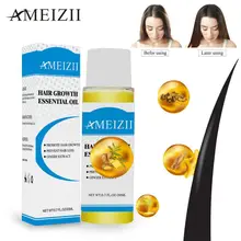 Ameizii 20 мл натуральные продукты эфирного масла для волос органический имбирь экстракт женьшеня Сыворотка для ухода за волосами плотная эссенция для лечения