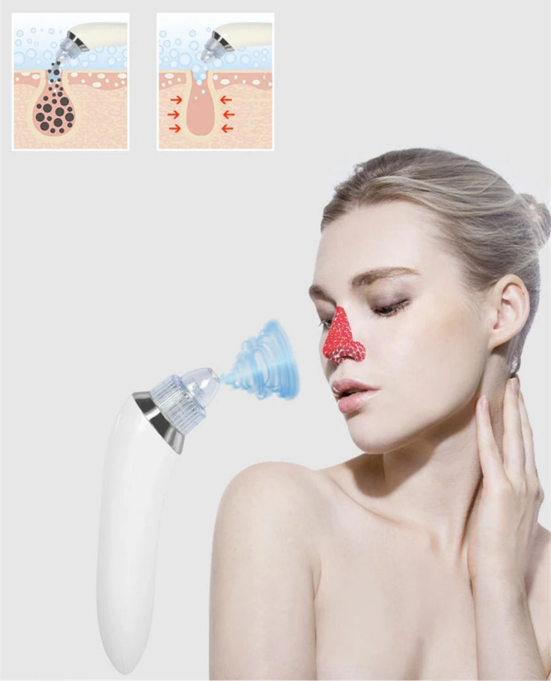 

Electric Vacuum Pore Cleaner Blackhead Remover Acne Clean Dermabrasion Device Skin Care Tool + Makeup Brush Beauty Device