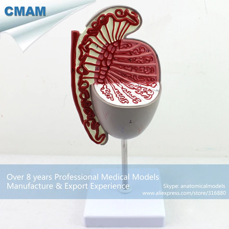 12429 CMAM UROLOGY09 Enalarge 3.5x Human Testis Dissection Testicle