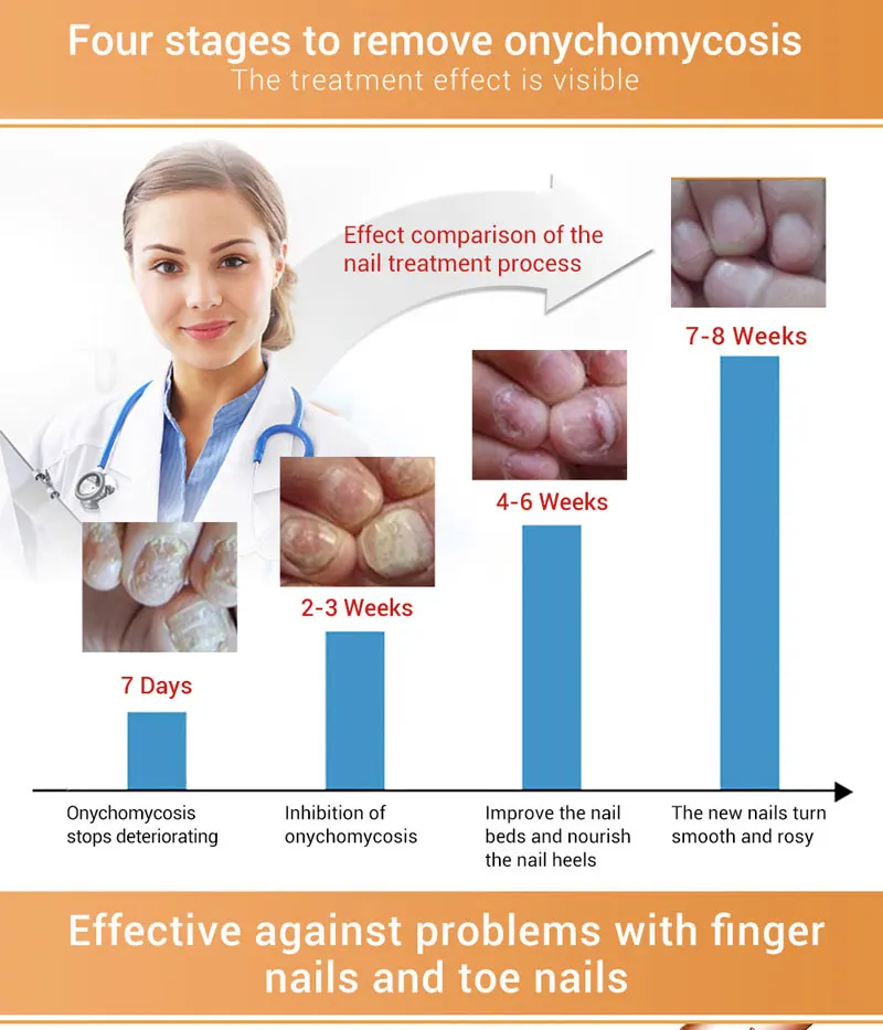 nail-repair-essence-3_02