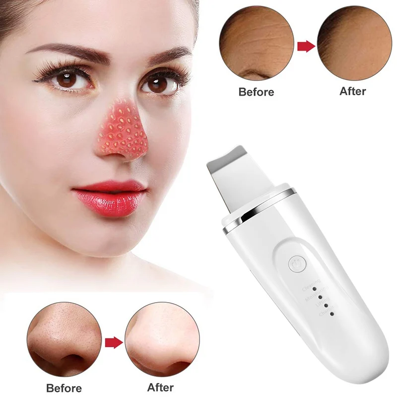 

Ultrasonic Ion Deep Cleaning Skin Scrubber Peeling Shovel Facial Pore Cleaner Blackhead Remover Face Lifting USB Rechargeable
