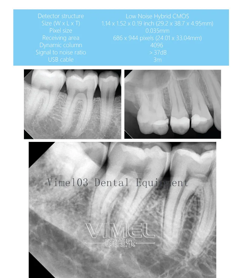 Корейский Vatech Ez стоматологический рентгеновский датчик/жесткий стоматологический Датчик Размер 1,5