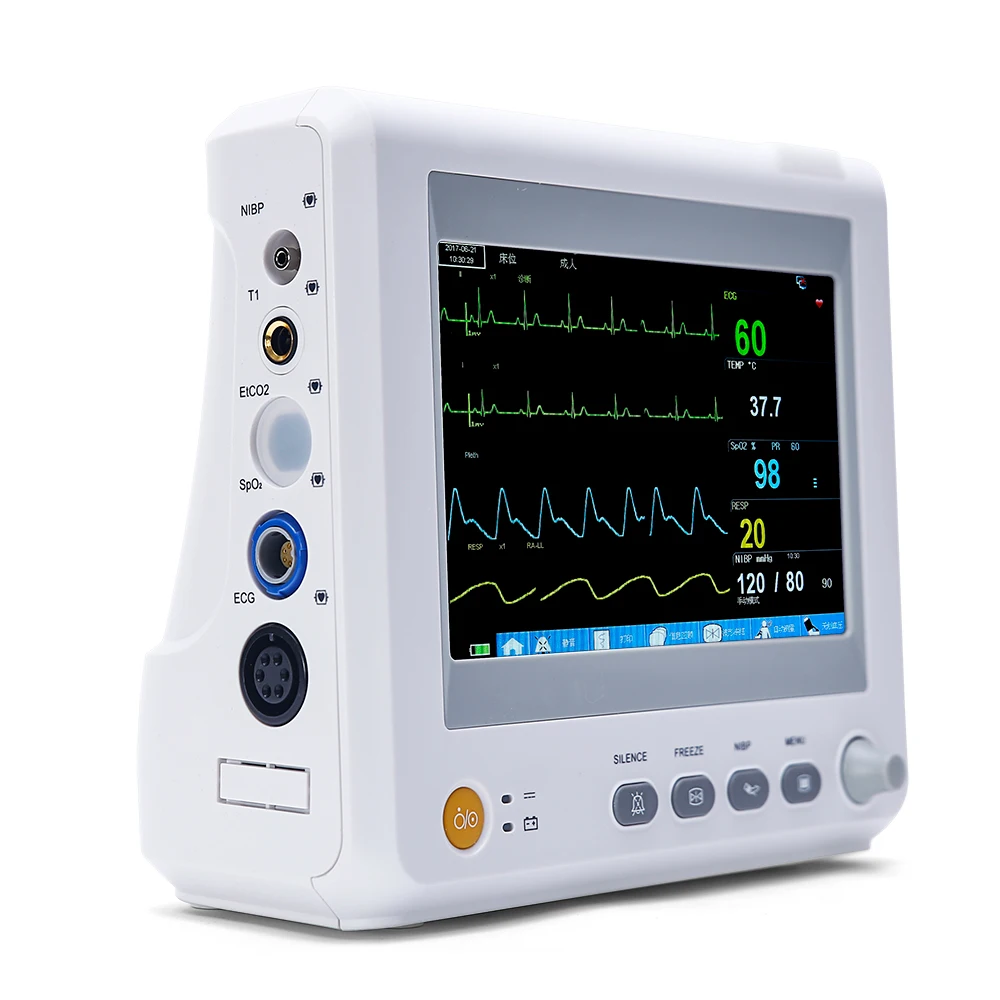 Yongrow медицинский 7 дюймов ICU CCU монитор пациента лучшая цена 6 параметров монитор пациента оборудование монитор пациента в отделении интенсивной терапии жизненный знак