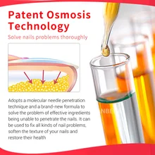 Гель для ремонта ногтей Лечение грибков удаление онихомикоза ногти ног Питательный Уход за ногами OR88