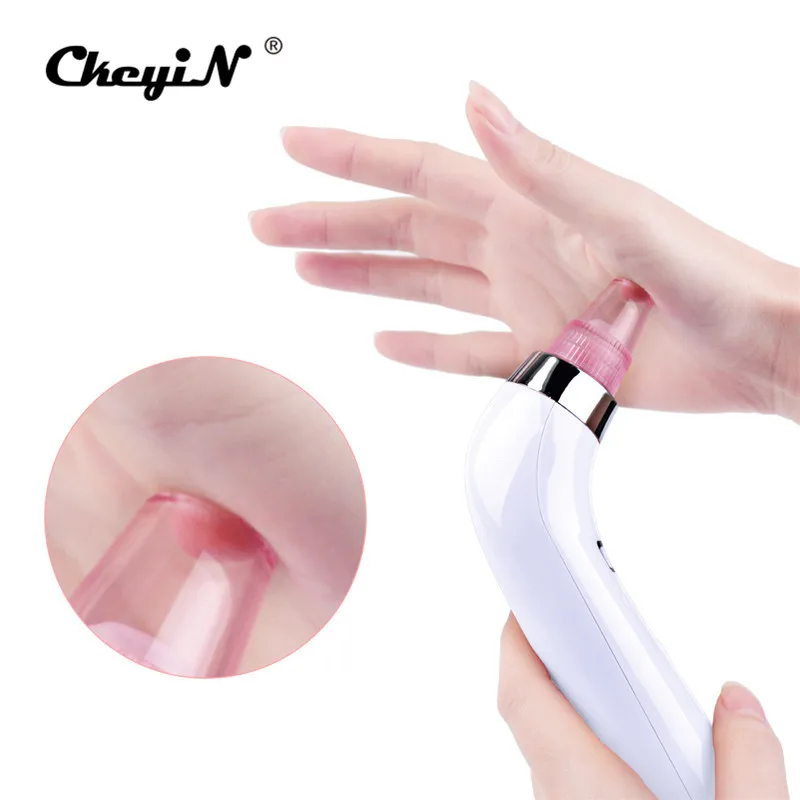 Goedkoop CkeyiN 4 IN 1 Afzuiging Gezicht Pori euml;n Neus Mee euml;ter Cleaner Deadskin Peeling Removal Microdermabrasie Schoonheid Instrument S50