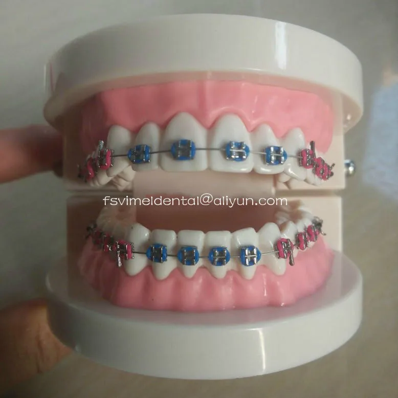 Dental orthodontic plastic teeth study model with elastic bands color bracket and elastic chain