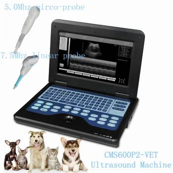 

Ultrasound Machine with two probe