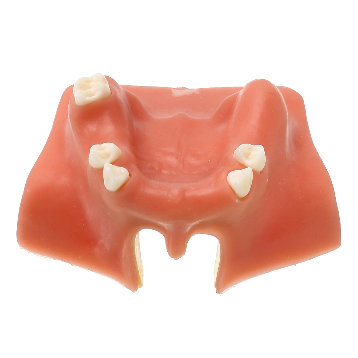 

Resin Maxillary Teeth Model Upper Jaw Sinus Lift Implants Restoration Dental Practice Model For Medical Teach Study Demostration