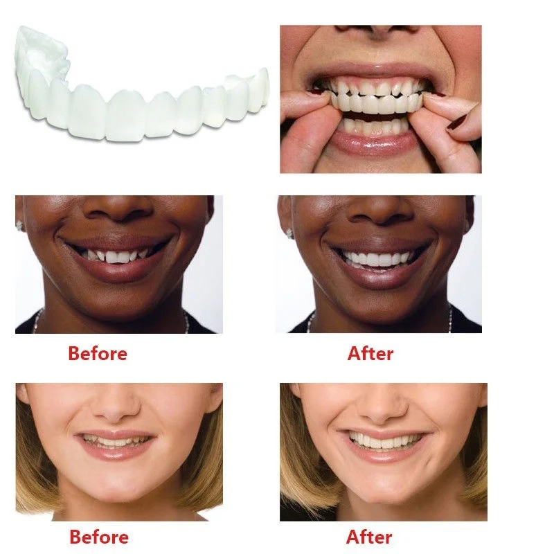 2018 new smiley teeth orthodontic ortodoncia correction teeth spots