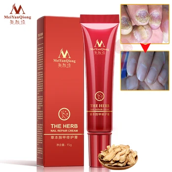 

MeiYanQiong Brand Nail Foot Protector Skin Care Cream 15g Nail Fungus Treatment the Herb Nail Repair Cream