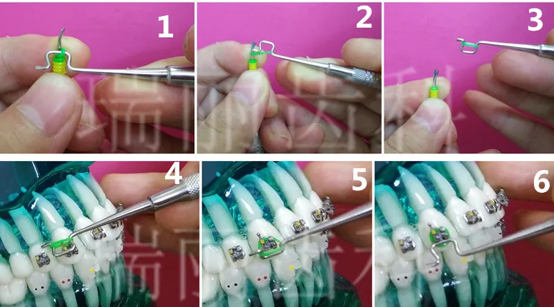Стоматологическая Ортодонтическая вертлюга-на модуле Лигатура связать россыпью размещение Convinient использование инструмента