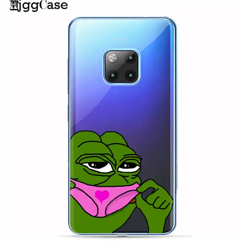 A5410