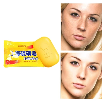 

Sales Hot Sulfur Soap Skin Care Treatment Natural Skin Soap Blackhead Remover Acne Treatment Control Oil