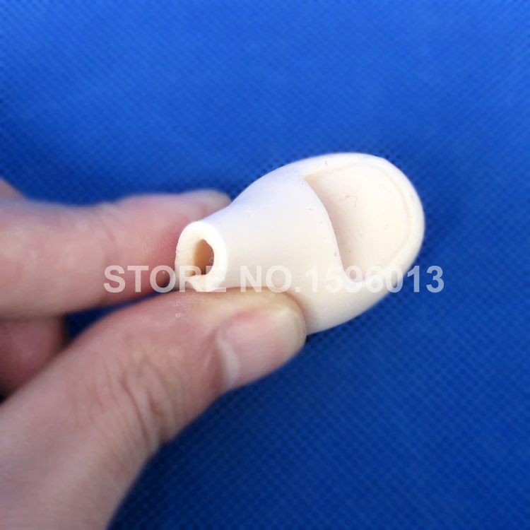 LV6-1 Ingrowing Toenail (3)