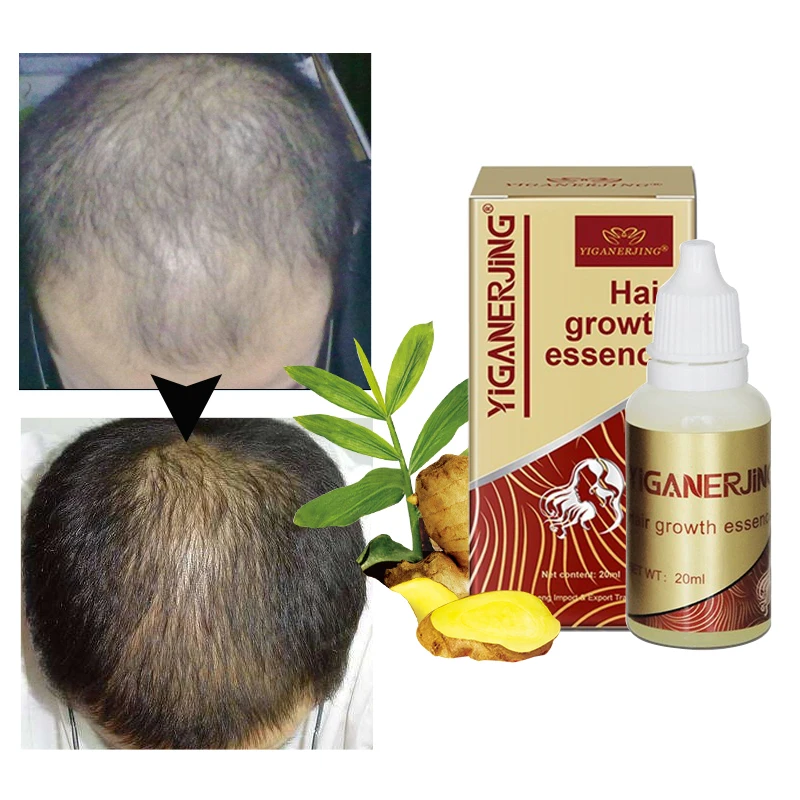 

Hair Serum Ginger Oil Hair Growth No Hair Loss Hair Mask Polygonum Repair Treatment Essence Faster Grow Care 20ml