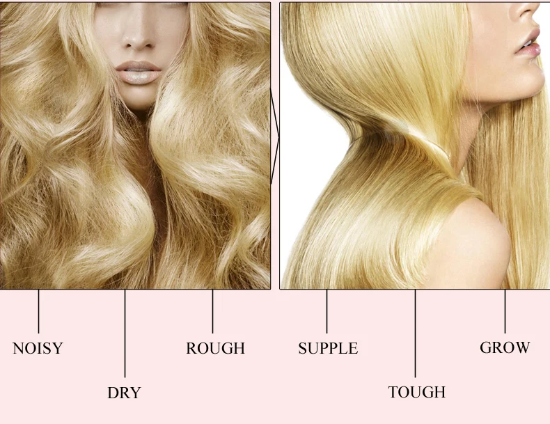 20 мл жидкость для ухода за волосами с орехами для роста быстро мощная эссенция для роста волос продукты для выпадения волос Эфирное Масло жидкое лечение TSLM1