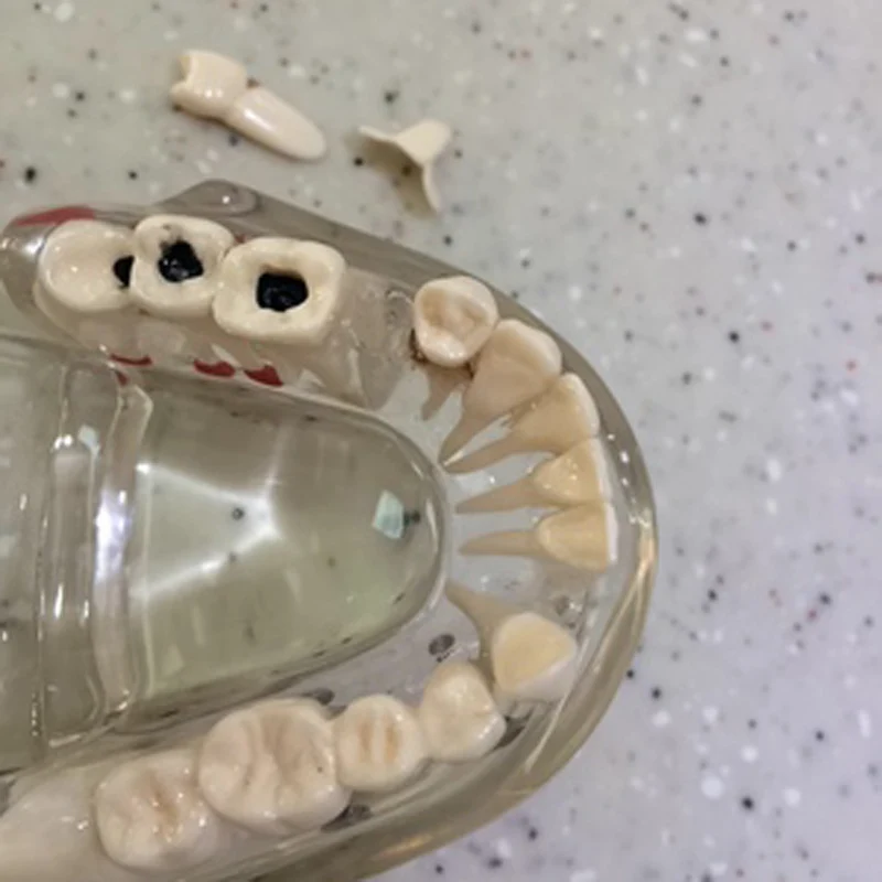 Стоматологические материалы съемные стоматологические патологические модели специальные украшения клиника украшения на заказ фигурки