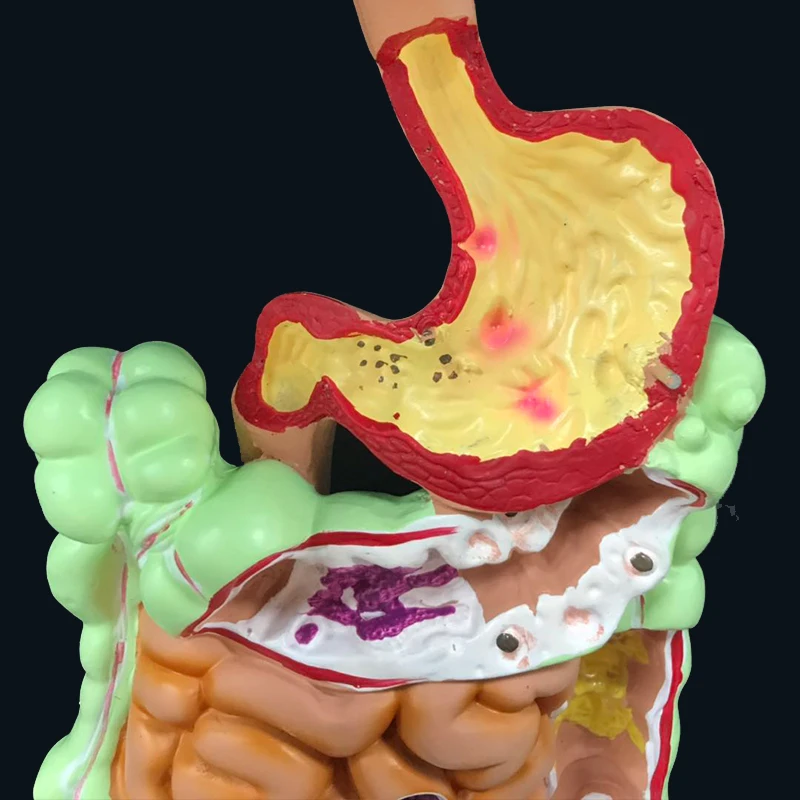 Человеческая пищеварительная система желудка анатомическая модель большой кишки Cecum прямой кишки Duodenum Анатомия манекен для медицинского обучения