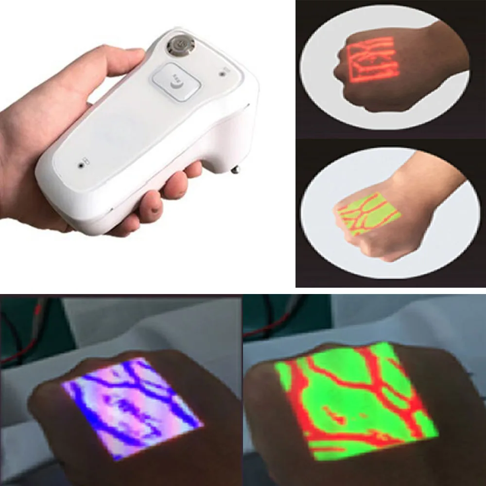 Portable projection near-infrared vascular imaging light puncture-assisted high-definition venous blood vessel display